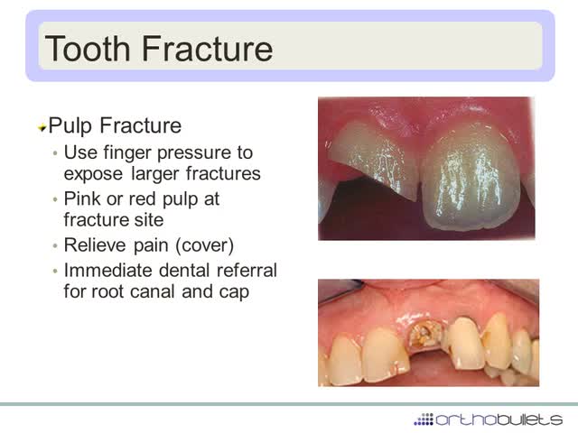 Ear, Eye, Mouth Injuries - Knee & Sports - Orthobullets